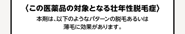 〈この医薬品の対象となる壮年性脱毛症〉本剤は、以下のようなパターンの脱毛あるいは薄毛に効果があります。